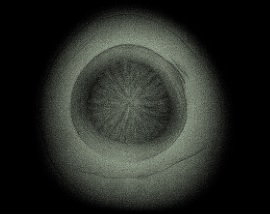 Cross-section of a Pearl Structure